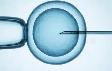 Fertilización in-vitro